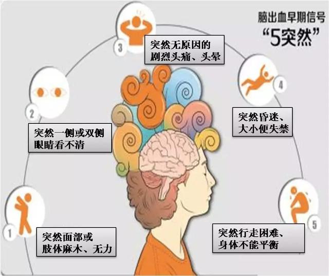 当心！预防冬季脑血管疾病&ldquo;三大杀手&rdquo;之脑出血（三）