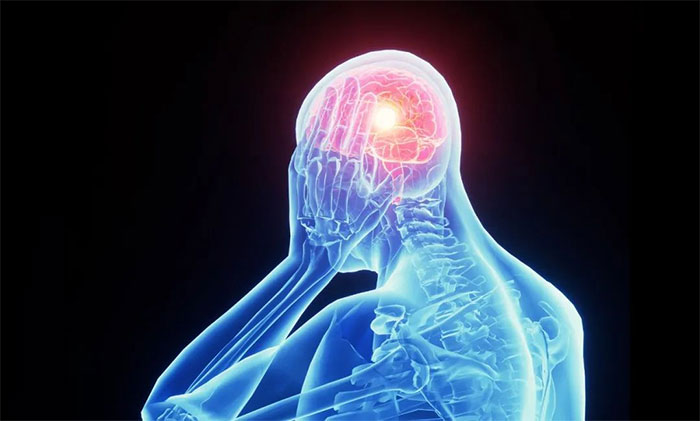 出现不明原因反复头痛，要警惕脑肿瘤！